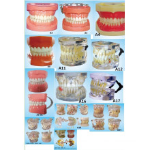 Matériel d&#39;éducation en sciences orales Dentition standard Modèle de dents de modèle de dents